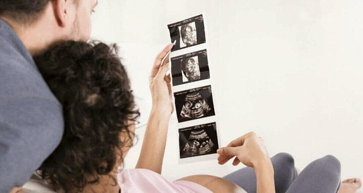 Expecting parents looking at sonogram