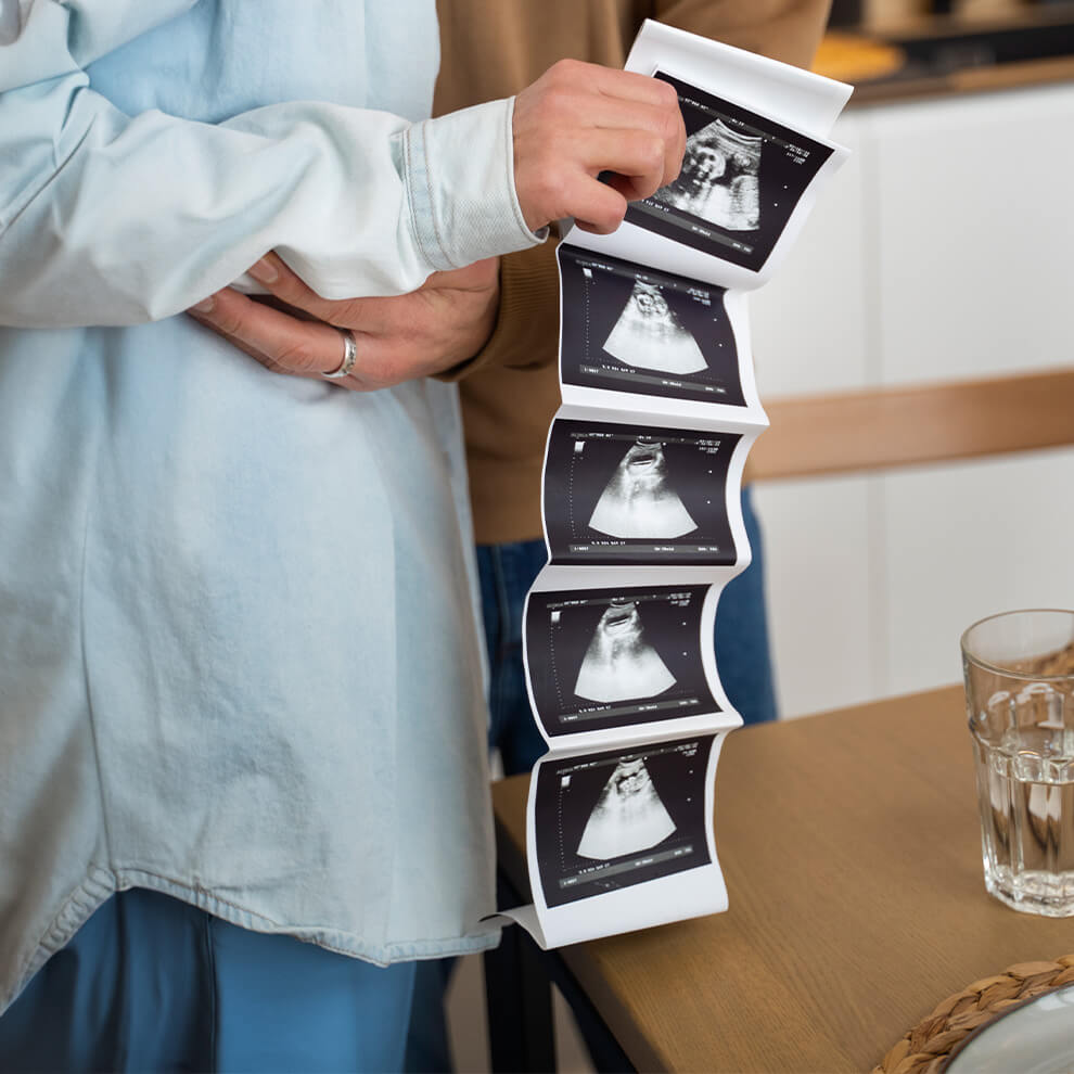 A woman clutching baby scan pictures